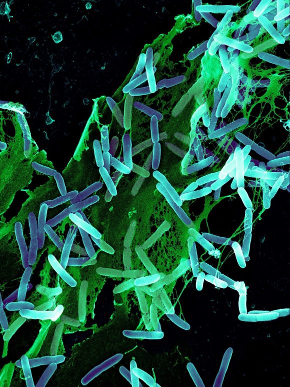 Micrograph of bacterial cells undergoing quorum sensing